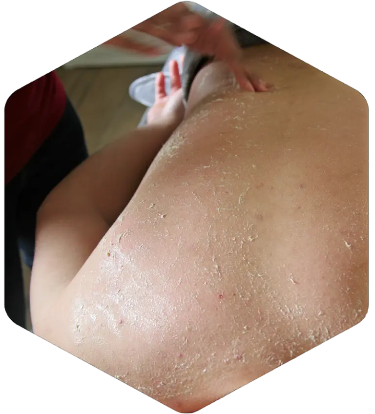 Honigmassage-2-768x848.webp